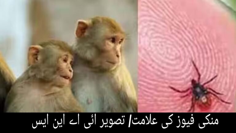 کرناٹک کے شمالی کنڑ ضلع میں ’منکی فیور‘ کا پھیلاؤ! 21 معاملوں کا انکشاف